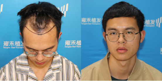 医院检查微量元素大概多少钱