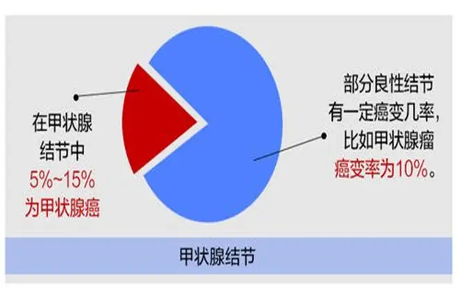 甲亢突眼补硒有用吗