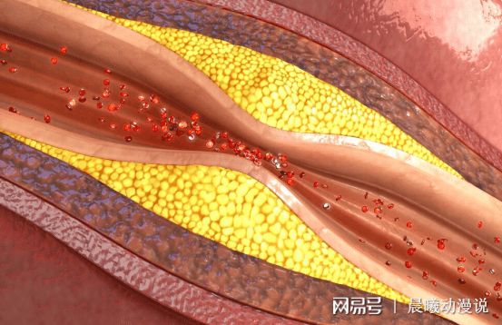 三高人群可以补硒么