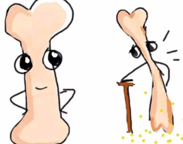 骨质疏松补钙