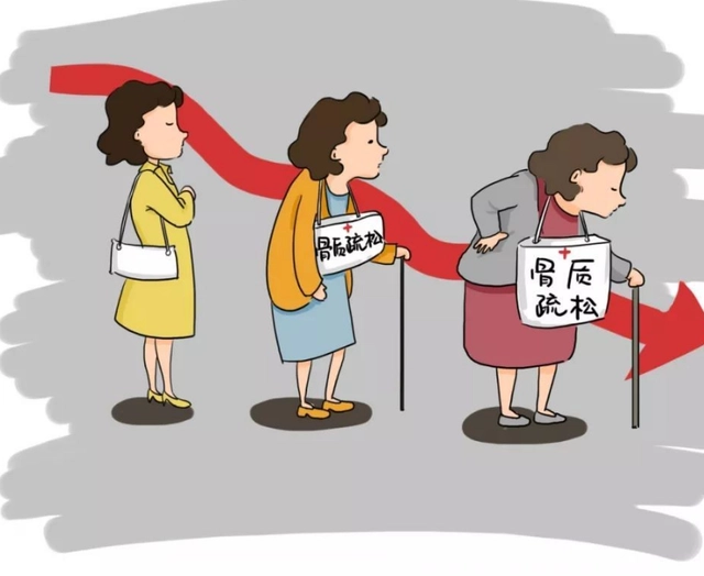 骨质疏松补钙