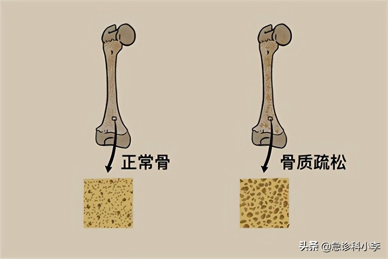 成年女性补钙吃什么钙片好