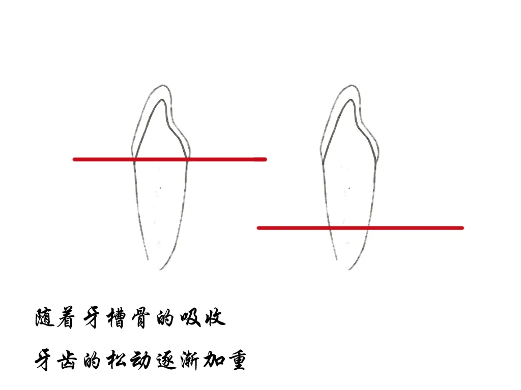 牙齿松动补钙有用吗