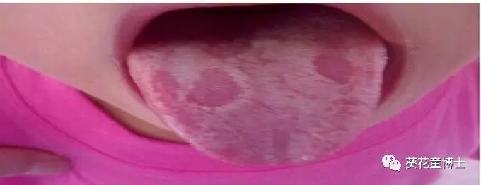 补锌要吃多久