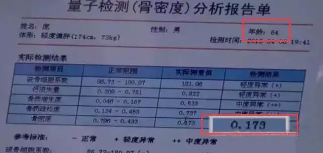 60岁以上老人补钙吃什么钙片好