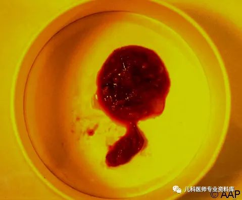小孩子补锌吃哪个牌子的比较好