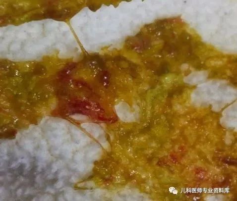 小孩子补锌吃哪个牌子的比较好