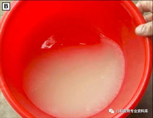 小孩子补锌吃哪个牌子的比较好