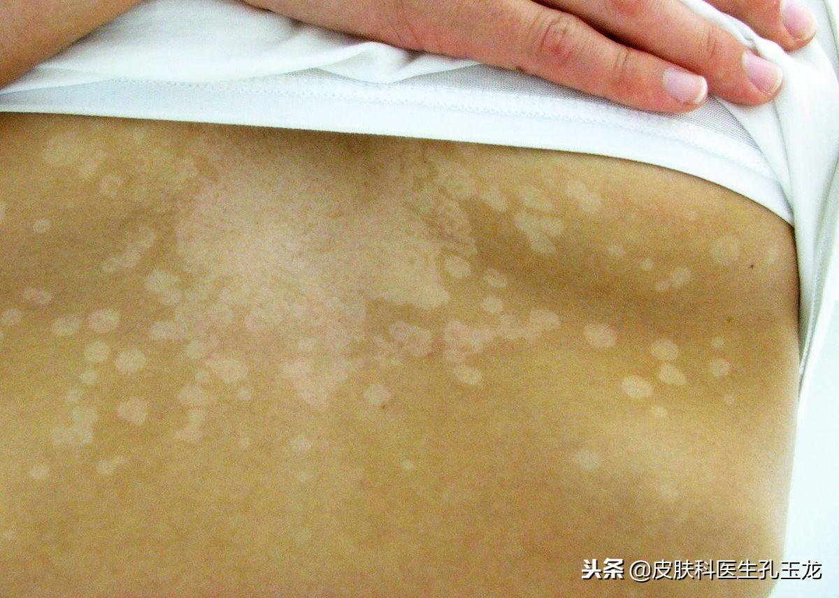 怎样补锌