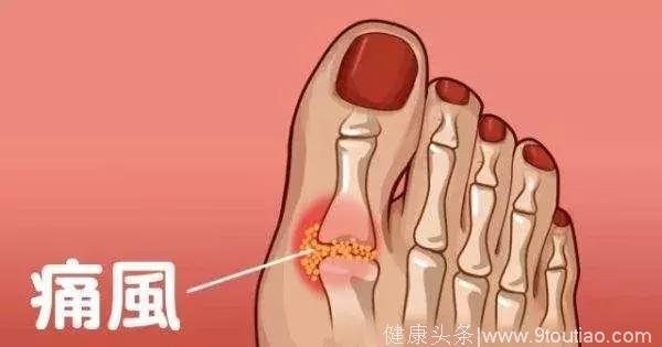 血钠低怎么补