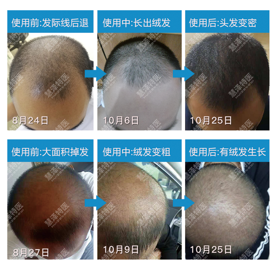吃什么可以补充微量元素