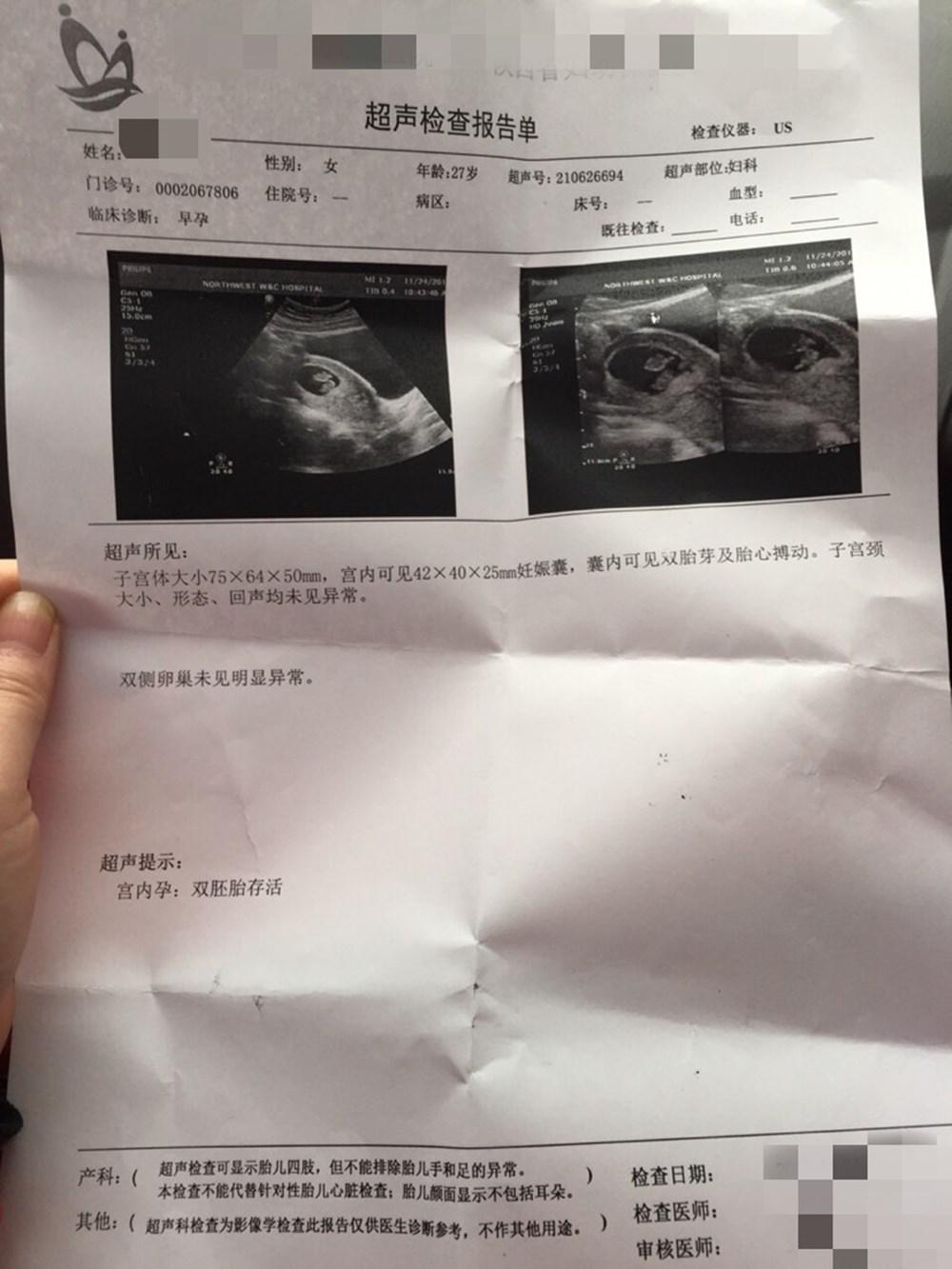 小孩子查微量元素需要空腹吗