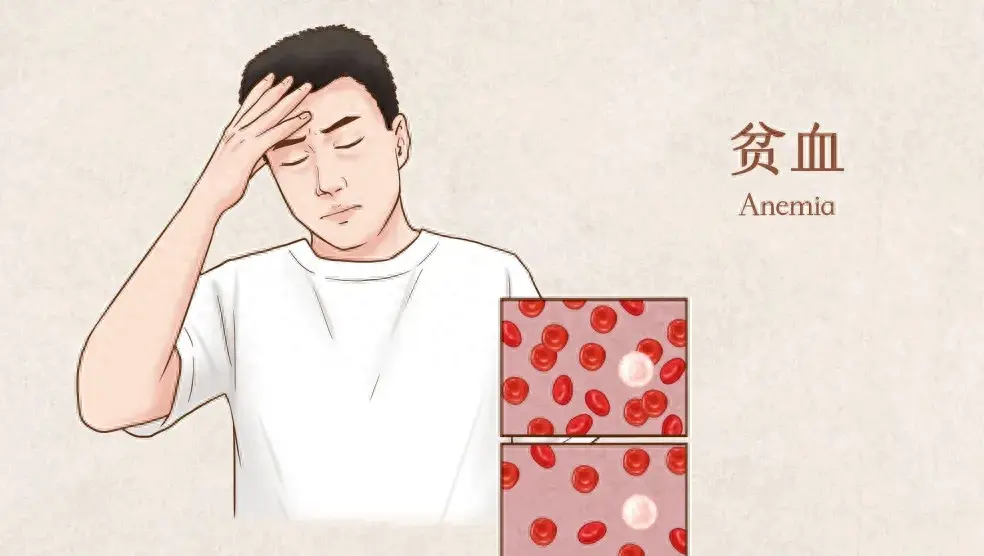 儿童补铁剂