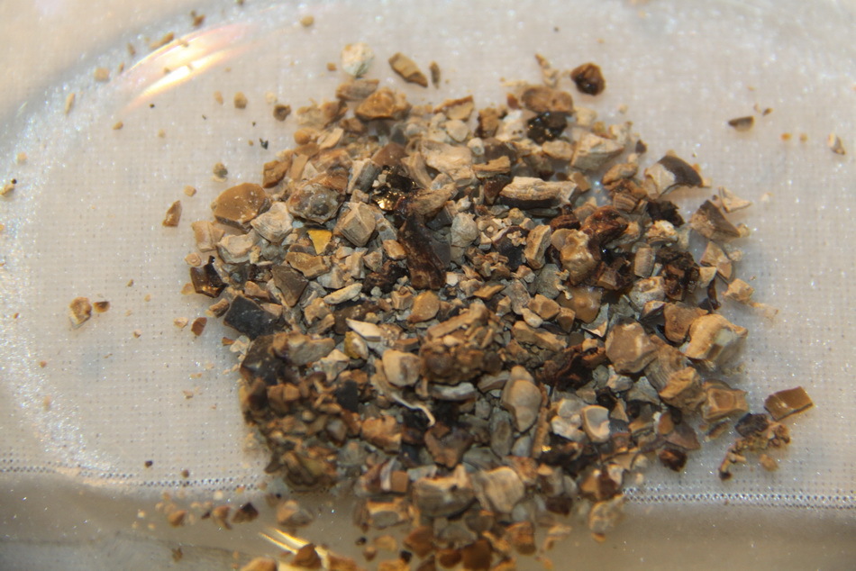 肾结石补钙用哪种钙片