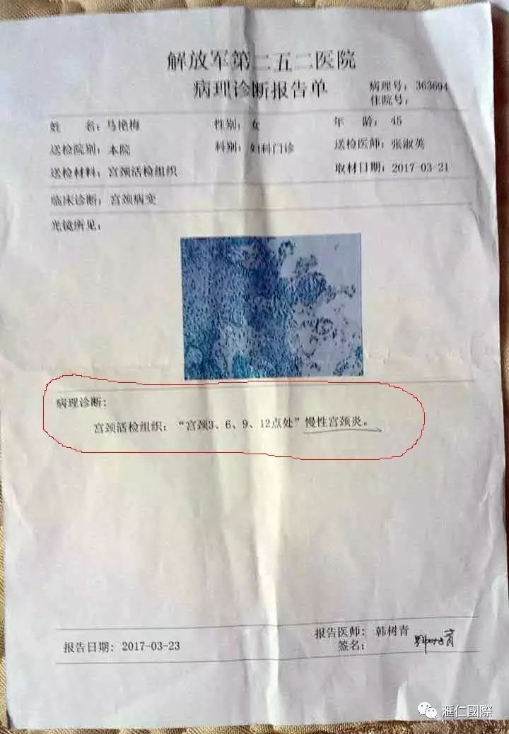 直肠癌能吃硒维康吗