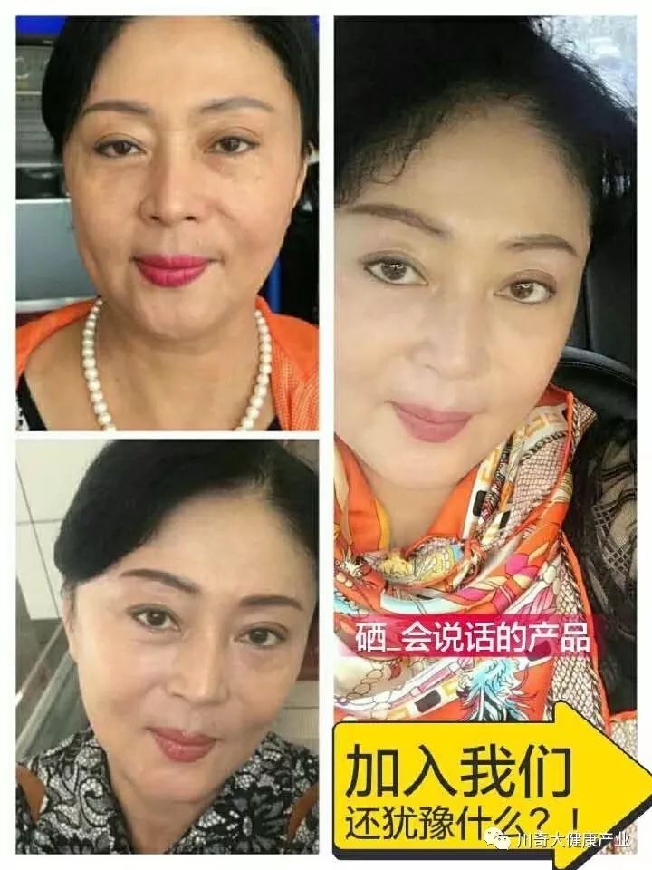 直肠癌能吃硒维康吗