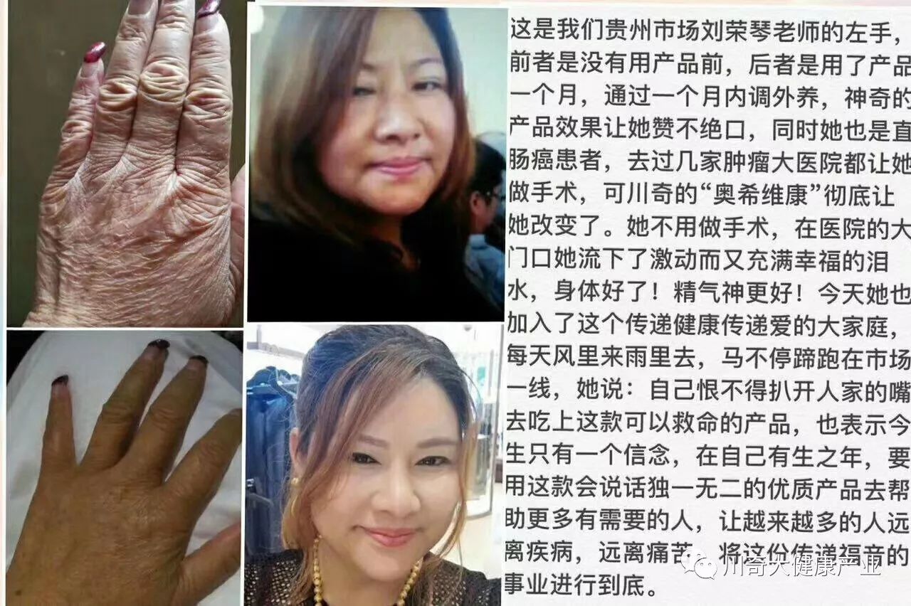 直肠癌能吃硒维康吗