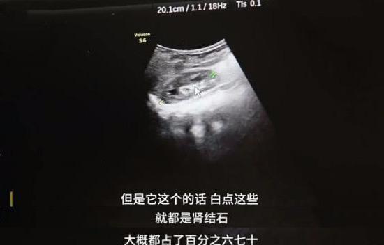 补钙图片