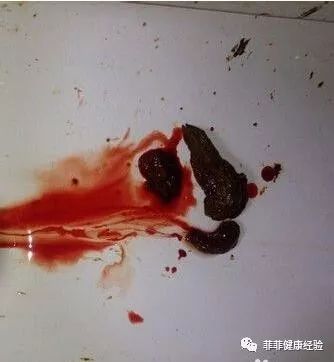 硒维康片能治胃病吗