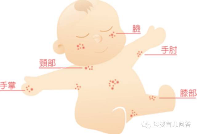 宝宝吃锌硒宝起疹子