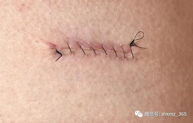 补锌吃什么
