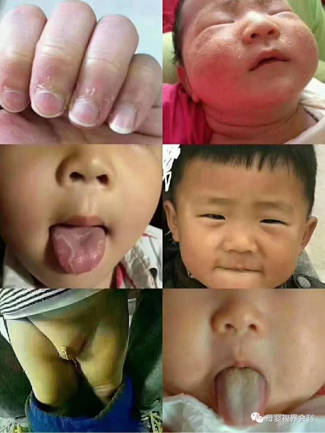 成人补锌