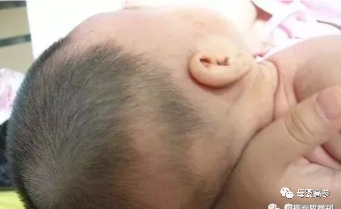 3个月的宝宝需要补钙吗