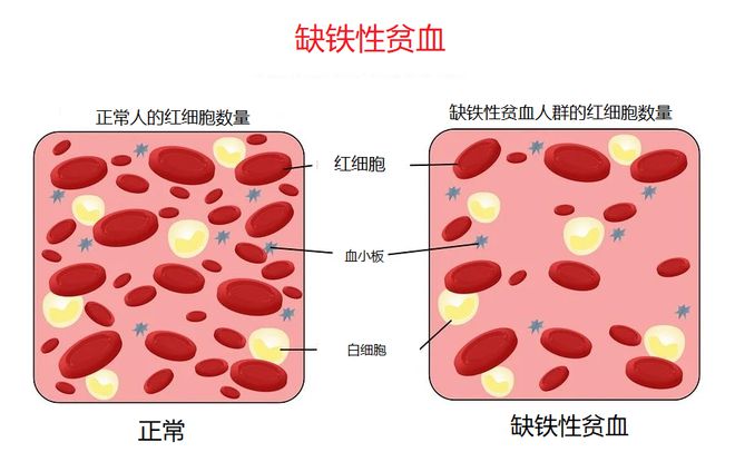 怎么补铁元素