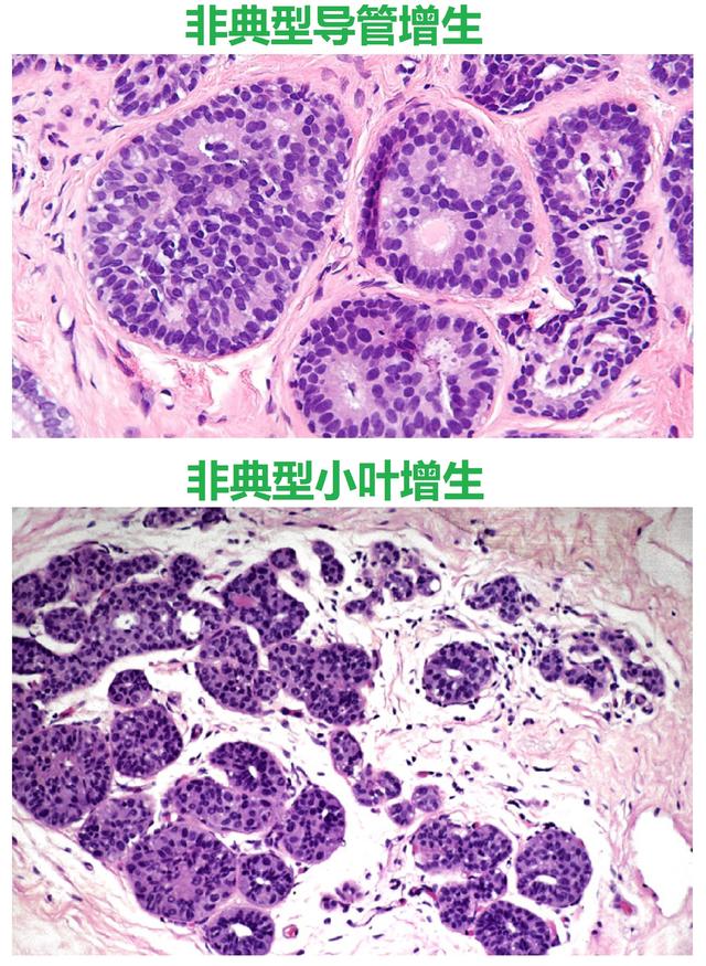 隔着玻璃晒太阳能补钙吗