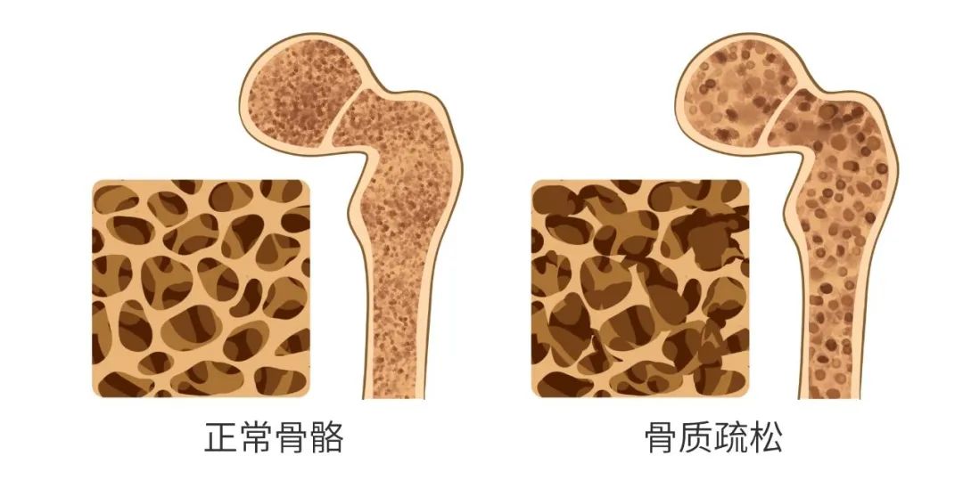 打补钙针好不好