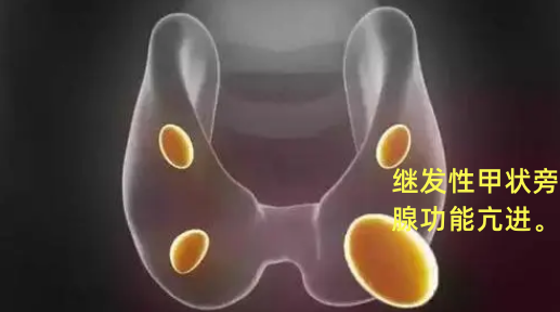 打补钙针好不好