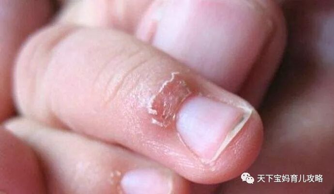 缺锌吃什么食物能补锌