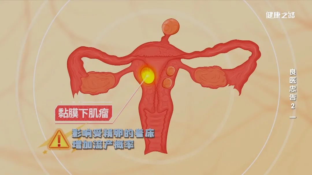子宫内膜癌需要补硒吗