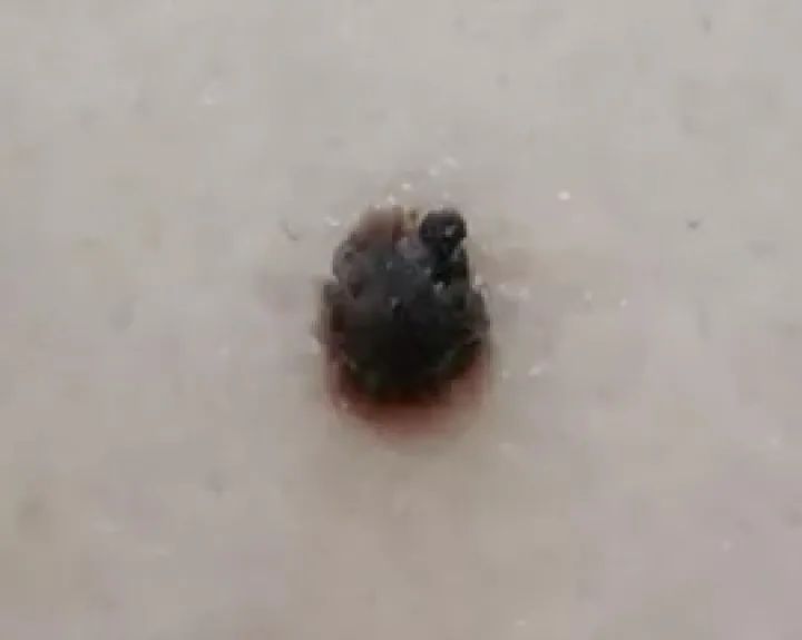 补硒大小便有什么变化