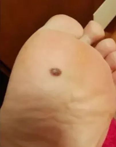 补硒大小便有什么变化