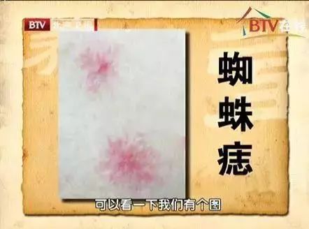 补硒能预防老斑产生吗
