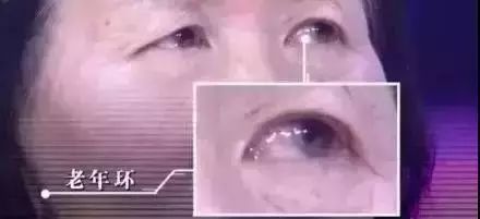 补硒能预防老斑产生吗
