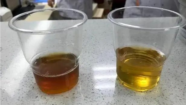打补钙针