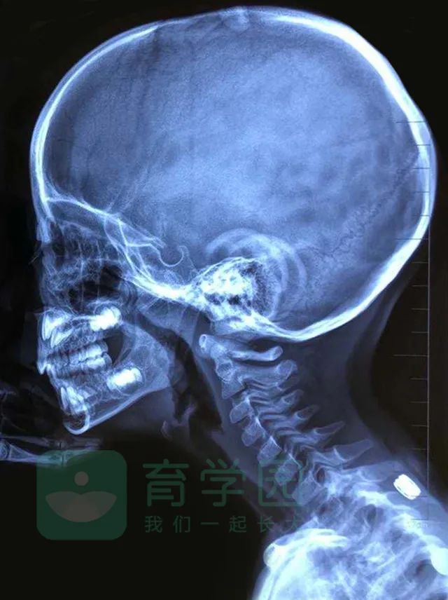 多大开始补钙