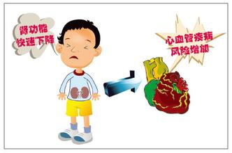 脑血栓患者补硒有用吗
