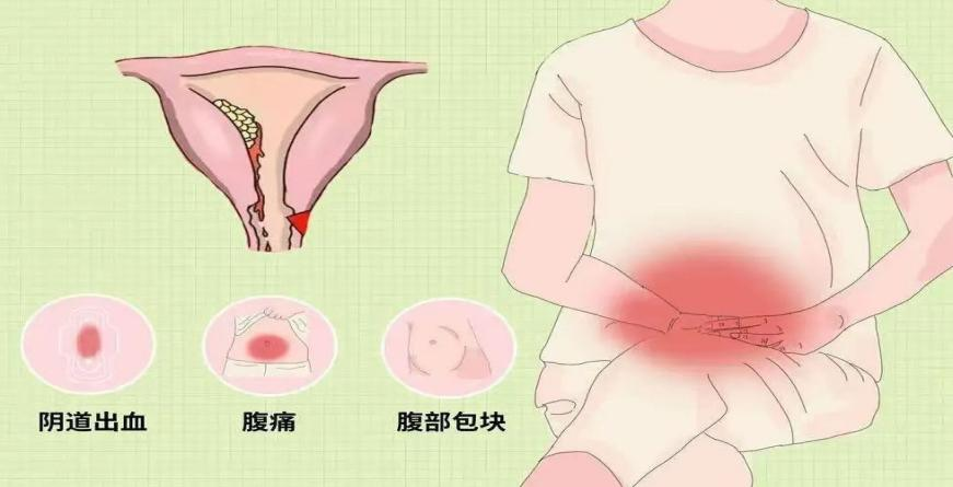 补硒防治子宫内膜癌吗