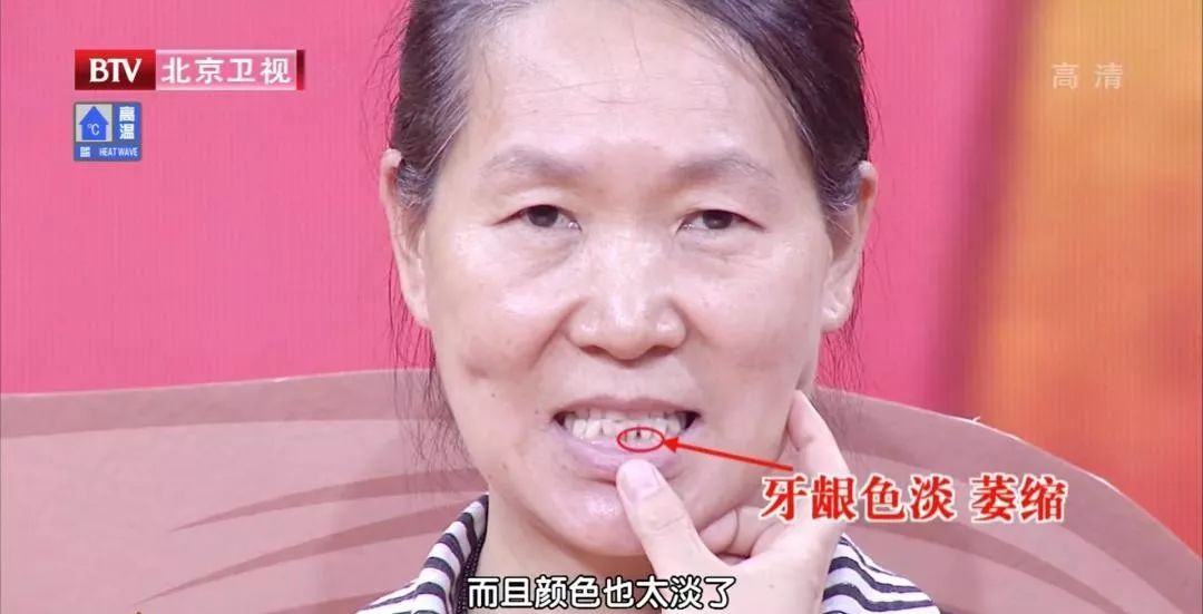 菠菜补铁吗