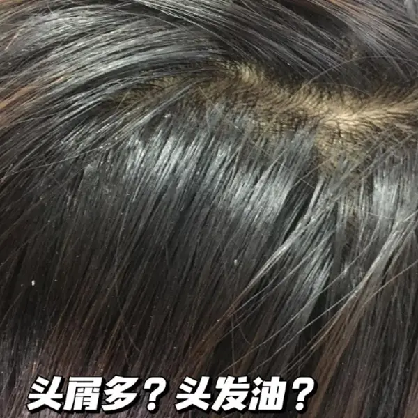 补哪款硒洗发水好用呢