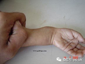 儿童要补钙吗