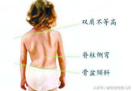 一岁半宝宝缺硒怎么补