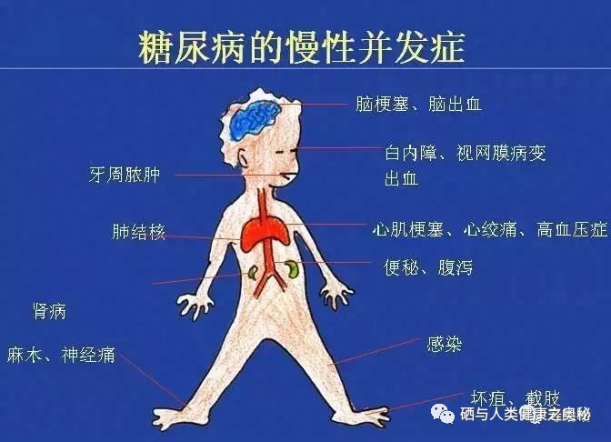 糖尿病人可长期补硒吗