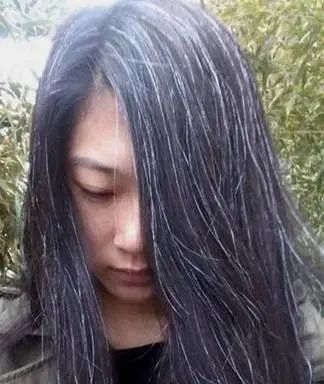 孩子有白头发是缺少什么微量元素