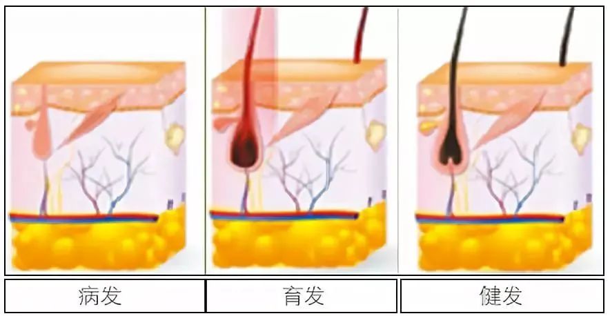 孩子有白头发是缺少什么微量元素
