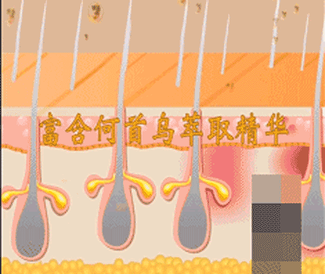 孩子有白头发是缺少什么微量元素