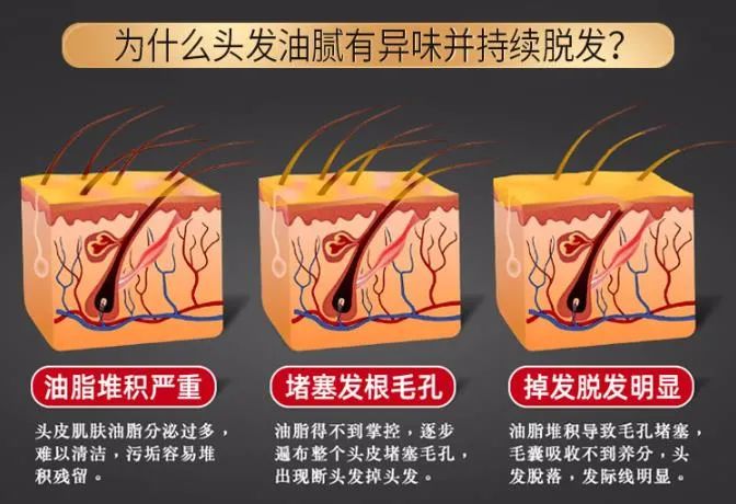 孩子有白头发是缺少什么微量元素